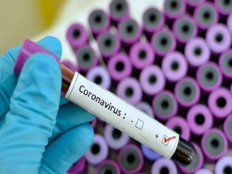 فوری/افزایش مبتلایان به ویروس کرونا در کهگیلویه وبویراحمد +آمار