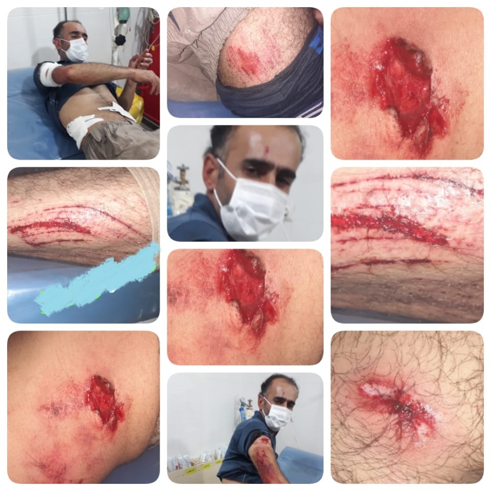 حمله پلنگ به یک جوان در استان کهگیلویه و بویراحمد+عکس