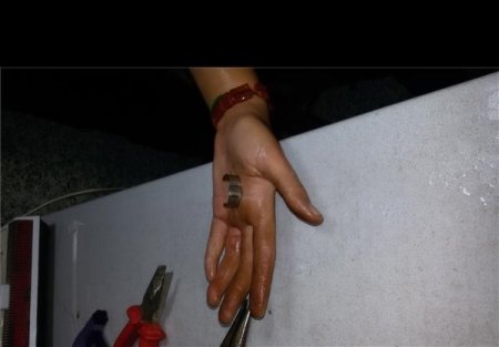 رهاسازی انگشتر از دست دختر نوجوان دیشموکی+تصاویر